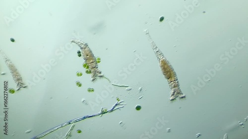 Rotifer under Optical Microscope at 100x Magnification