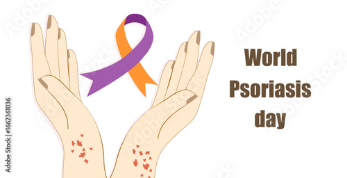 World Psoriasis day on October 29th. Hands with skin disease holding orange and purpe color ribbon on white background. Vector Not AI generated