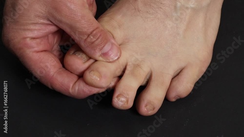 A man checks his toes by touching them with his hands, caring for his toenails.