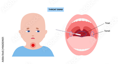 Swab throat procedure