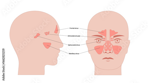 Paranasal sinus poster