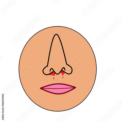 nose bleeding infection ijnury accident epistaxis blood from nose illustration medical .eps