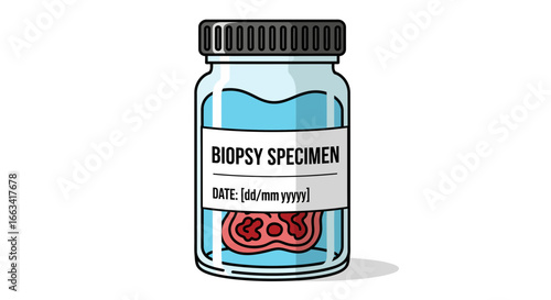 Biopsy Specimen Jar with Medical Sample Inside, Healthcare and Medical Research Concept