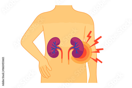 Human figure showing kidneys with pain indication in illustration kidney pain illustration