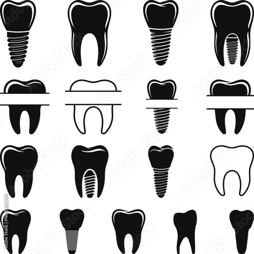 Dental implants and teeth silhouettes set, Tooth implant svg bundle, tooth icons, illustration