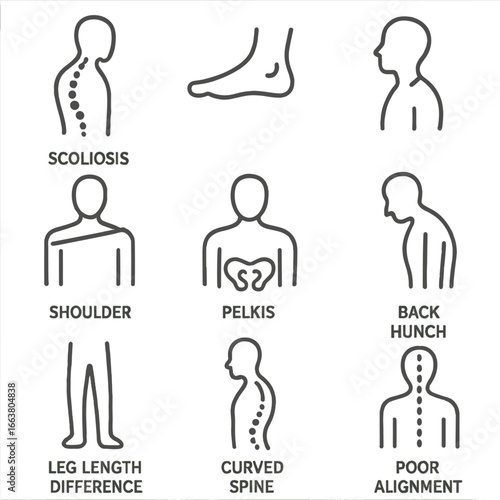 Posture Issue Icons. Line style icons of common posture issues: scoliosis spine, flat feet, neck tilt, shoulder imbalance, pelvis