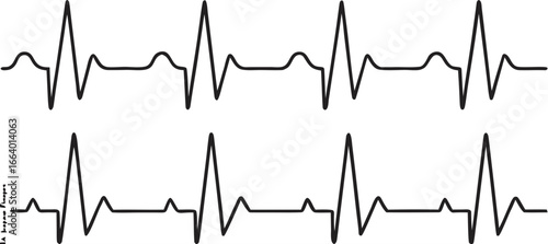 Heartbeat line set. EKG. Vector 
