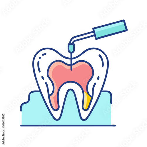 Illustration of tooth decay process with dentist tool examining cavity