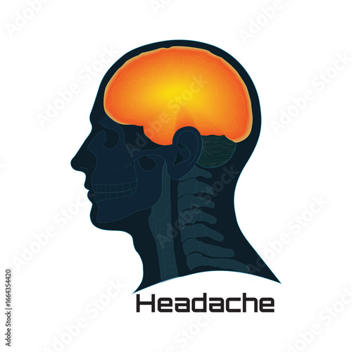 Anatomical Head Profile with Glowing Brain and Skeletal Structures Visible. Illustration of a person suffering from a headache.