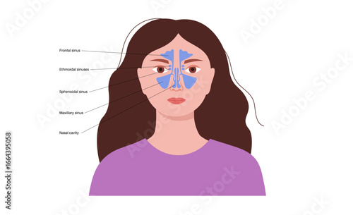 Paranasal sinus poster