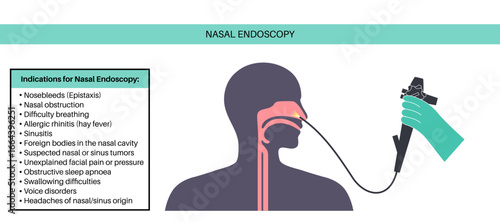 Nasal endoscopy poster