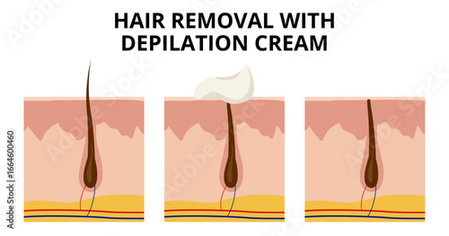 Depilation cream dissolving hair on skin