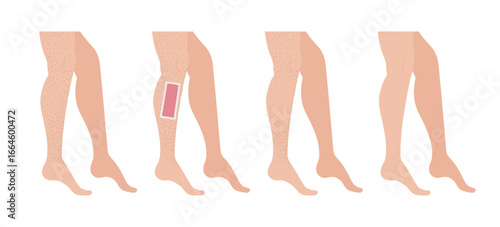 Hair removal stages using wax strips on male legs