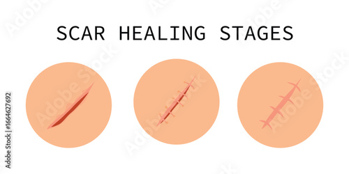Set of healing wounds, skin scars, stitched gash and cuts