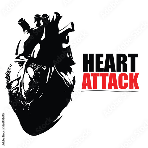 Heart Attack ECG Vector – Cardiology, Paramedic, Cardiac Health Illustration