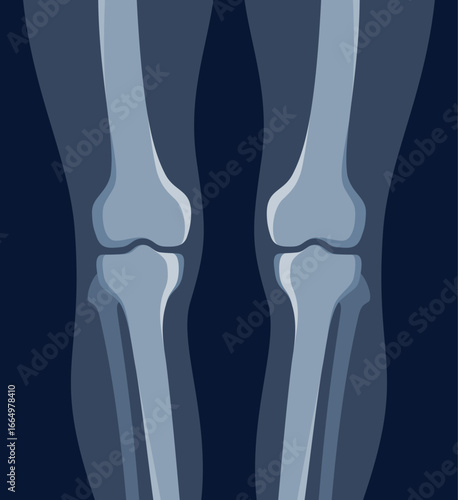Knee human legs x ray roentgen radiology shot medical healthcare vector flat illustration