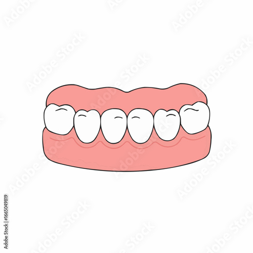 Dental bridge illustration with teeth on pink gum background, isolated on white background     