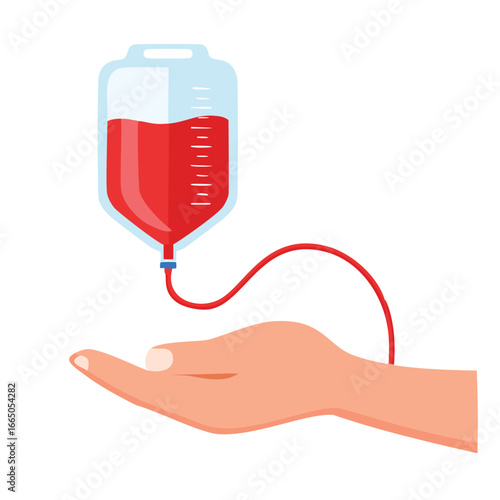 Blood bag with red liquid being transfused into an open hand blood transfusion medical