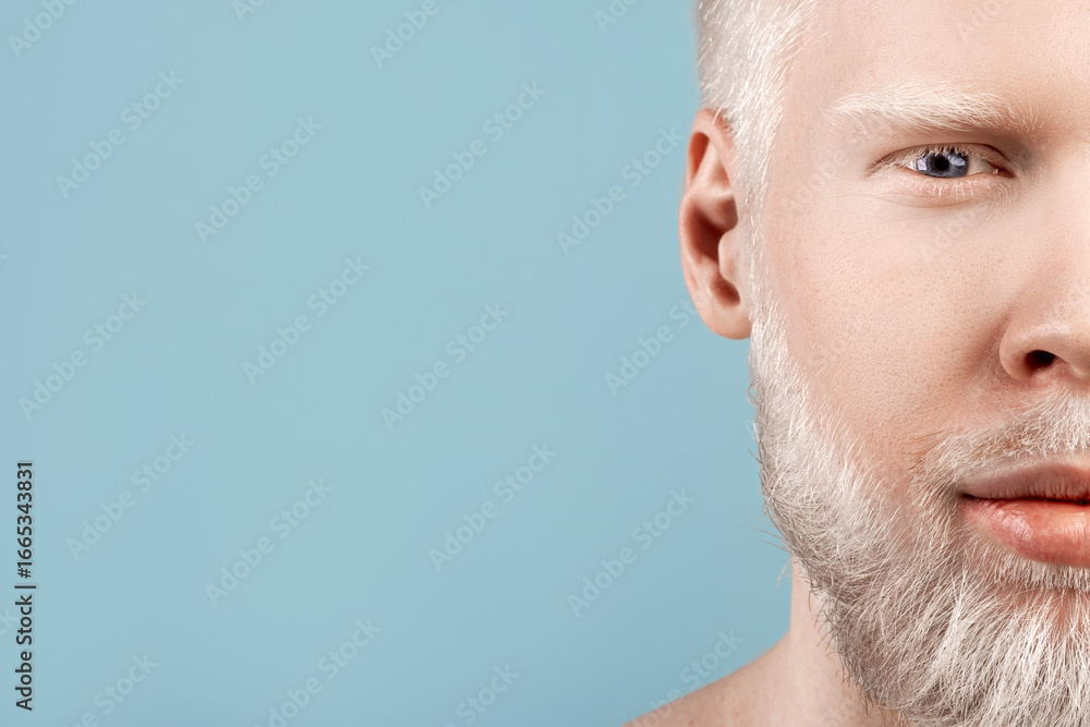 Fototapeta premium Albinism. Portrait of albino bearded man with white hair and pale skin looking at camera over grey background with free space. Unusual appearance and skin abnormality