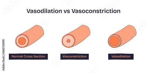 Vasodilation vs Vasoconstriction shows blood vessel changes, highlighting normal, constricted, and dilated arteries, transparent background. Doodle style diagram