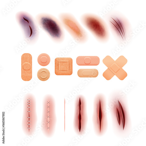 Medical Wounds and Healing: A medical illustration featuring different types of skin wounds, cuts, and the healing process using bandages, suture to create a visual narrative