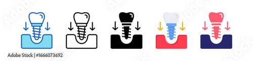 Dental Implant Multiple Style Icon Set Collection. 