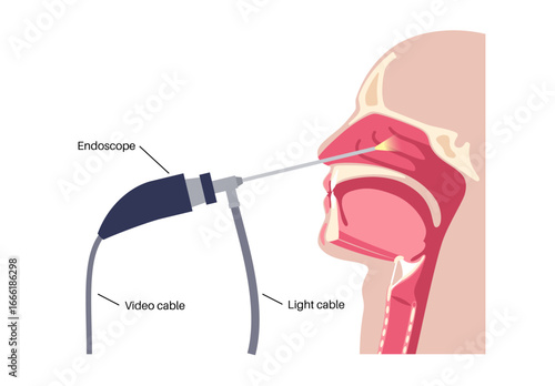 Nasal endoscopy poster