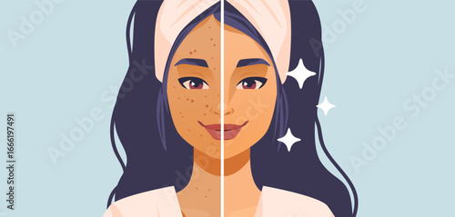 Woman skincare before and after acne treatment facial split clean glowing skin beauty transformation headband flat color background