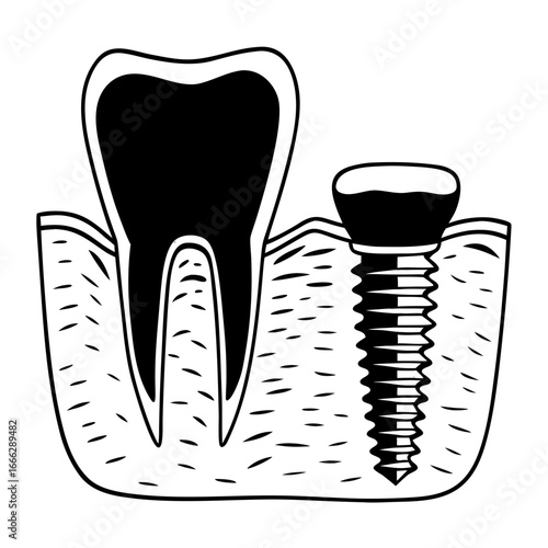 Tooth implant illustration in detailed line art design  