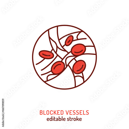 Vector medical icon of blocked vessels showing blood clot and circulation disorder.