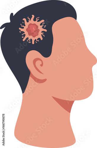 Medical Vector of Brain Tumor in Human Head