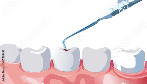 Dentist tool inspecting decayed tooth in vector for school health campaigns
Dental hygiene vector showing cavity detection for children’s health education
