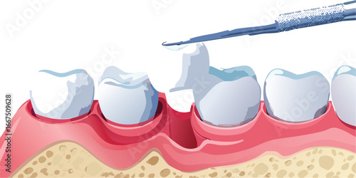 Oral health awareness vector with decayed tooth and dentist tool for education
Dental care education vector showing cavity detection in a clean tooth row