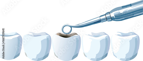 Educational vector showing dental tool inspecting cavity in realistic tooth row
Oral health awareness vector with decayed tooth and dentist tool for education

