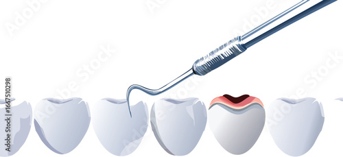Tooth decay detection concept for dental hygiene education and awareness campaigns
Dentist tool examining decayed tooth in educational vector for oral care promotion