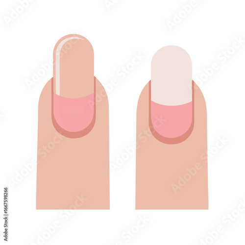 Fingernails before and after polish application