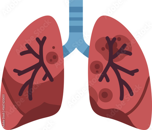 Diseased Human Lungs Medical Illustration with Spots organ respiratory system disease illness