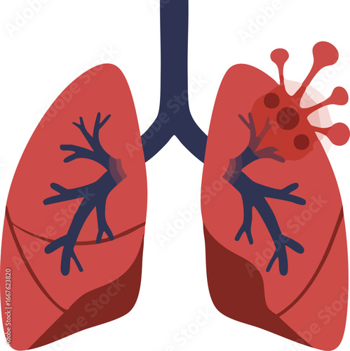 Lungs Infected with Virus Illustration on White Background (1) infection respiratory illness