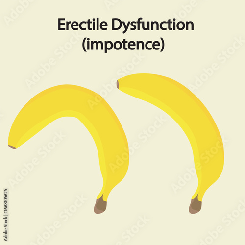 Vector illustration of erectile dysfunction showing difficulty achieving erection, low libido, and related conditions like Peyronie’s disease and hormonal disorders banana 