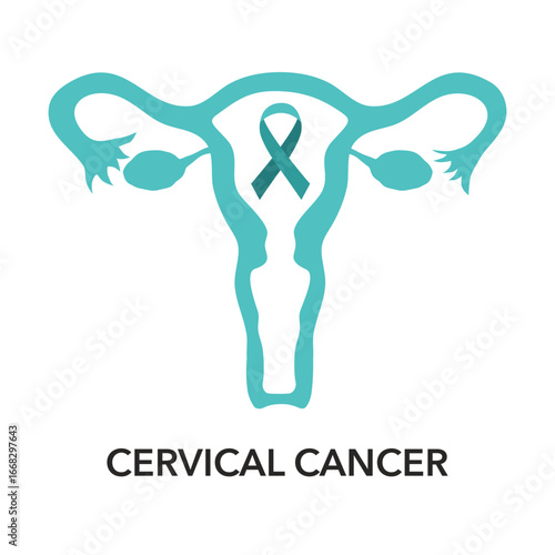 Cervical cancer. Carcinoma. Malignant neoplasm. Cut-away view of the uterus. female reproductive system. Vector illustration like X-ray image for healthcare design. Reproductive health
