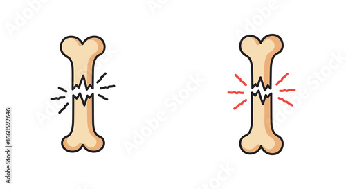 bone fracture comparison with and without pain