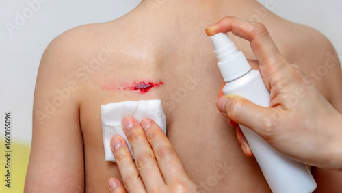 Child receiving care for a minor wound in a bright and clean indoor location, with an adult applying antiseptic spray