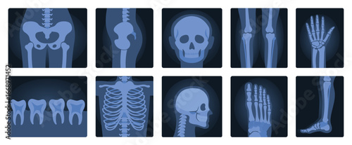 Xrays films of human body set, radiography and anatomy vector illustration. Cartoon isolated medical roentgen scans with silhouettes of bones of skeleton, joint and articulation of legs and hands