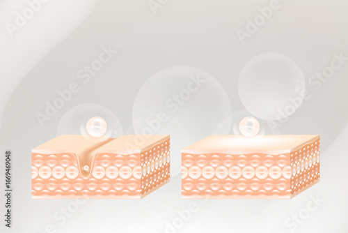 Hyaluronic acid and Niacinamide before and after skin solutions ad, white collagen serum drops into skin cell with cosmetic advertising background ready to use, illustration vector.