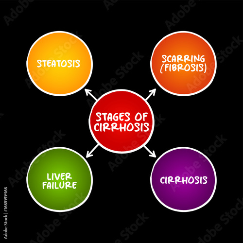 Stages of cirrhosis (scarring of the liver caused by long-term liver damage) mind map text concept