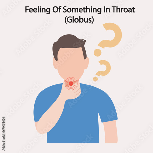 Feeling of a lump or tightness in the throat without pain, often worse when swallowing saliva. Symptoms include discomfort, dryness, frequent throat clearing. Similar to GERD, anxiety, pharyngitis.