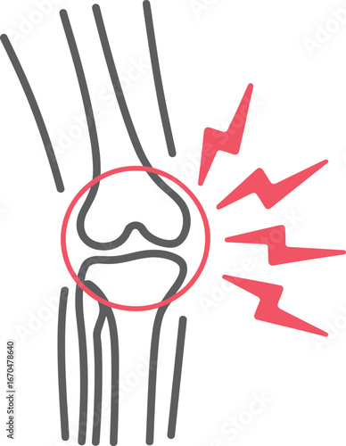 Knee joint pain illustration depicting medical condition