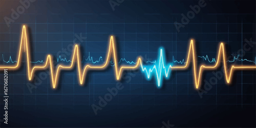 A medical ecg cardiogram graph shows a pulse rate heartbeat on a green line monitor