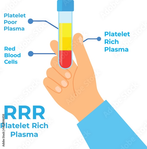Doctor holding a test tube filled with blood for platelet rich plasma injection procedure. Hand showing PRP blood composition. Stem cell regenerative medicine concept. Medical vector illustration