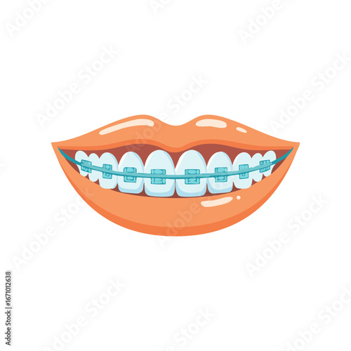 Smiling mouth with dental braces illustration